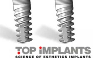 All-On-4 Dental Implants India