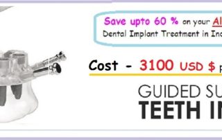 All-On-4 Dental Implants India