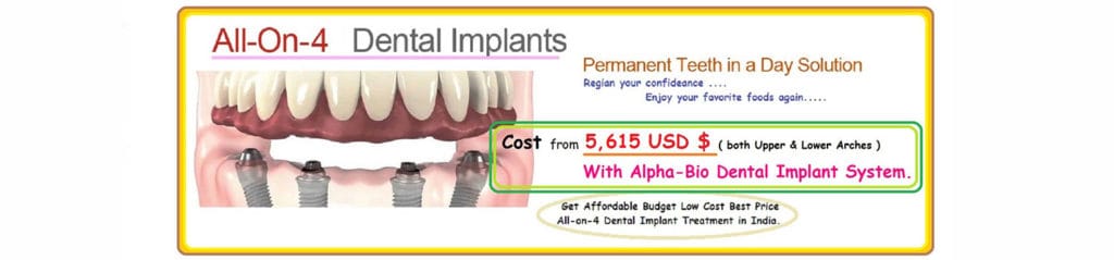 All-On-4 Dental Implants India