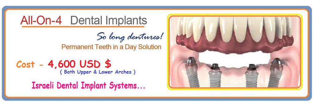 All-On-4 Dental Implants India