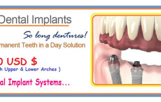 All-On-4 Dental Implants India