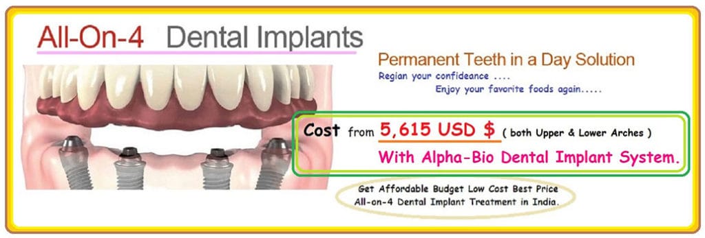 All-On-4 Dental Implants India