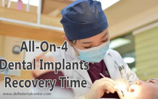 All-On-4 Dental Implants Recovery Time