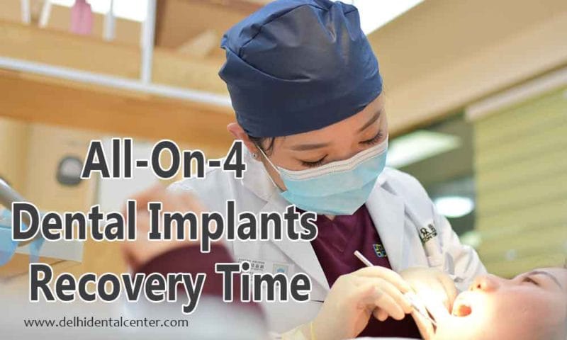 All-On-4 Dental Implants Recovery Time