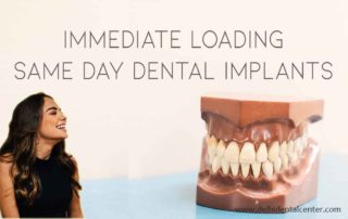 All on 4 Dental Implants Delhi