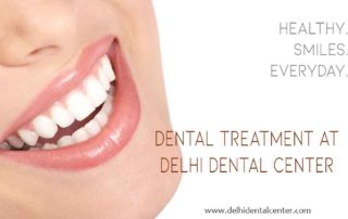 Dental Implant Delhi