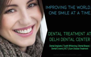 Dental Implant Delhi