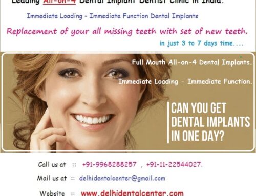Best Top All-in-4, Best price low cost cheap Dental Implants Abroad, Dental Tourism East Delhi, cheap dental implants abroad