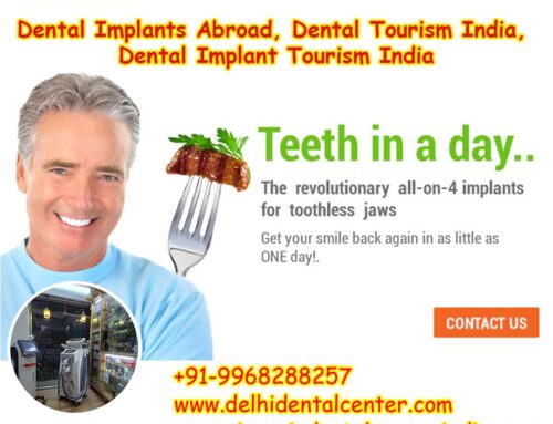 Best Top All-in-4, Best Top Dental Implant Treatment in India