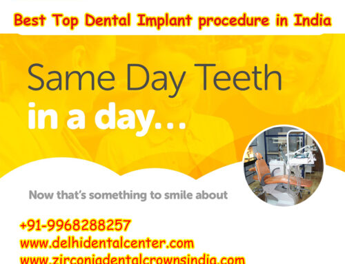 Best Top All-in-4, Best Top Dental Implant procedure in India.