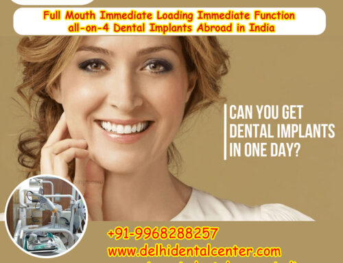 Best Top All-in-4, Full Mouth Immediate Loading Immediate Function all-on-4 Dental Implants Abroad in India.