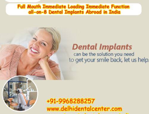 Best Top All-in-4, Full Mouth Immediate Loading Immediate Function all-on-8 Dental Implants Abroad in India.